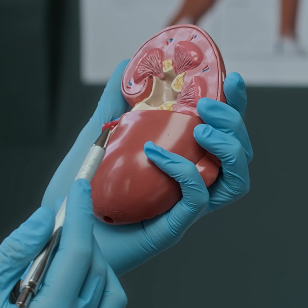 Anatomy model of a kidney held by hands in blue gloves with a pen-like tool.